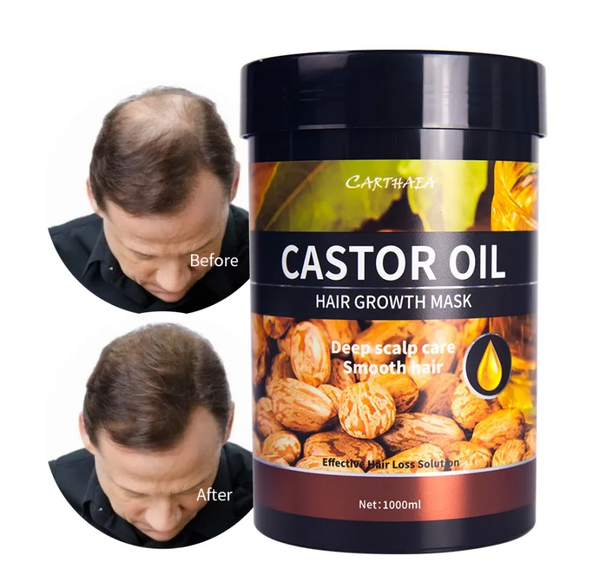 1000ml castor oil anti hair loss treatment hair growth mask