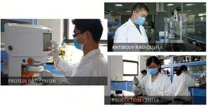 인간 중성구세포 젤라티나제 연관 리포칼린, <span class=keywords><strong>NGAL</strong></span> ELISA 키트 - Product Image 3