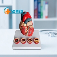 Modelo de Enseñanza Médica de Corazón con Trombosis, Simulador Realista de Patología Cardíaca para Entrenamiento de Cardiología CE/ISO