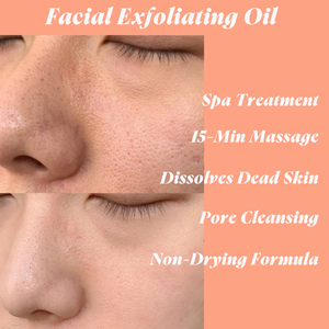 Exfoliant Visage Dissolvant d'Huile : Nettoyage Profond des Pores, Adoucissement des Points Noirs, Non-Exfoliant |   Fabricant sur mesure - Product Image 2