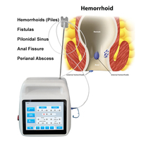 Nouveau 2025 : Traitement des fissures anales et des hémorroïdes – 1470nm 980nm – Médicament et traitement des hémorroïdes – Proctologie