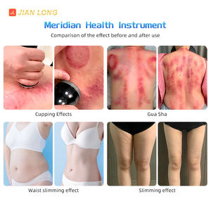 Jianlong Terapia bioeléctrica Máquina de terapia de ventosas al vacío DDS Masaje Máquina bioeléctrica Estiramiento DE LA PIEL Adelgazamiento corporal - Product Image 6