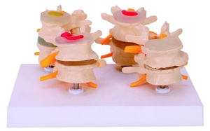 Vértebras lumbares con <span class=keywords><strong>hernia</strong></span> y <span class=keywords><strong>disco</strong></span> intervertebral sobresaliente Producto <span class=keywords><strong>de</strong></span> ciencia médica - Product Image 3