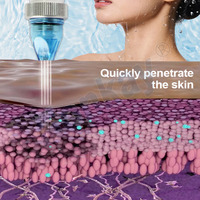 Máquina de Hidrodermoabrasión 3 en 1 para Limpieza Facial, Eliminación de Acné, Oxígeno en Spray, Antiarrugas, para Uso en Salones de Belleza