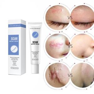 Crema Avanzada para Cicatrices, la Mejor Crema para Cicatrices Antiguas, Queloides y TKA, para Venta al por Menor - Product Image 4