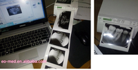 Printer Video Ultrasound Digital Portabel Harga Terjangkau Hitam Putih Hybrid Grafis Thermal Printer UP-X898MD