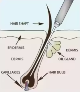 Elektrolyse-Gerät zur Entfernung weißer Haare/Elektronisches Instrument - Product Image 3