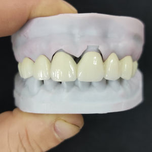 <span class=keywords><strong>Dents</strong></span> en zircone personnalisées de laboratoire dentaire numérique en Chine couronne et ponts en zircone solide - Product Image 3