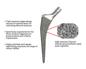 Sistema de Reemplazo <span class=keywords><strong>Total</strong></span> de Cadera Anatómico Profesional de Grado Médico Sin Cemento, Implantes Quirúrgicos de Titanio con Recubrimiento de HA para Fracturas - Product Image 2