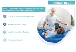 เครื่อง EECP เพื่อบรรเทาอาการปวดหัวใจและโรคหลอดเลือดหัวใจตีบ - Product Image 6