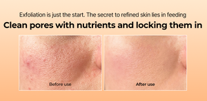 Tốt nhất bán Glow Peel bắn lỏng mặt nhắm mục tiêu Vỏ gạo bảo quản trong Ampoule tẩy da chết lỗ chân lông chăm sóc Gạo Huyết thanh với AHA - Product Image 4