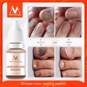 MeiYanQiong Lavender Nail Essence Anti Fungal Infection Strong Nails Treating Fungal Infections Nail Treatment Lavender Serum