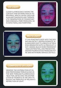การสังเกตสภาพผิว การตรวจจับใบหน้าแบบเต็มรูปแบบ หน้าจอขนาดใหญ่ การทดสอบผลิตภัณฑ์ การวิเคราะห์หนังศีรษะ การวิเคราะห์อัจฉริยะด้วย AI แบบสองฟังก์ชัน - Product Image 6