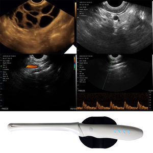 T8 초음파 드 마노 변환기 de 초음파 inalambrico convexo 질식 매트릭스 선형 - Product Image 2