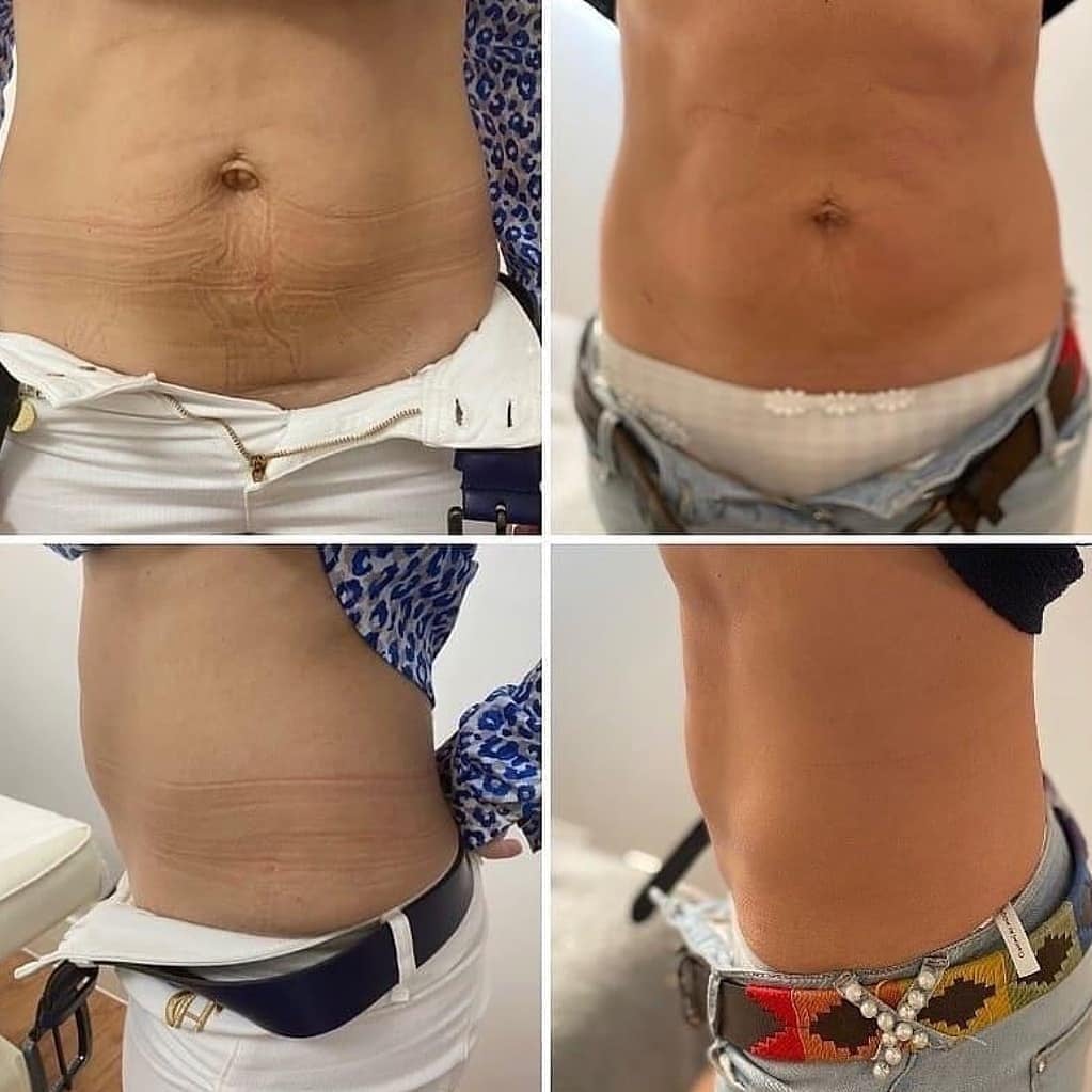 EMS Beauty Machine Stimulate Muscle Training Fat Loss Beauty Equipment