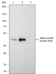 Anticuerpo Monoclonal de Actina Muscular Lisa Alfa Recombinante - Product Image 3