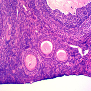 Material Didáctico Biológico YULIN, <span class=keywords><strong>Microscopio</strong></span> de Hematología Profesional, Portaobjetos Preparados, Hematograma, 25.4x76.2x1.2mm, Caja de Plástico/Madera - Product Image 5