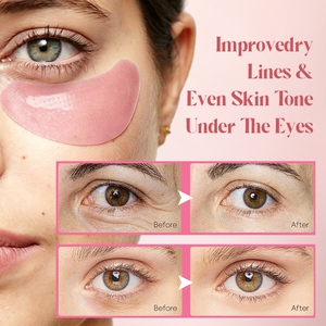 Masque pour les yeux à micro-aiguilles au collagène PDRN de saumon, marque privée, patchs pour les yeux, effet repulpant, <span class=keywords><strong>anti</strong></span>-âge, <span class=keywords><strong>anti</strong></span>-rides, patchs pour les yeux à micro-aiguilles - Product Image 5