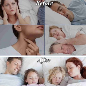 Improves Sleep Relieves <b>Snoring</b> Soft Mouth Tape Transparent <b>Strips</b> Hypoallergenic - Product Image 4