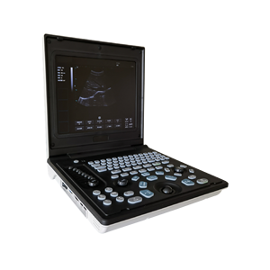 Appareil d'échographie portable de haute qualité pour usage vétérinaire, entièrement numérique, compatible avec plusieurs sondes, pour hôpital. - Product Image 1