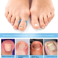 Patchs d'alignement des ongles en plastique sans colle, coussinets correcteurs pour ongles incarnés, patchs correcteurs pour paronychie