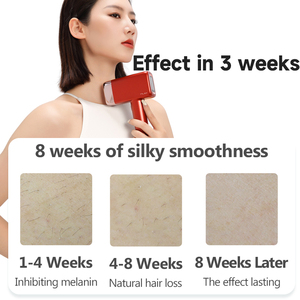 Macchina per Epilazione Laser <span class=keywords><strong>IPL</strong></span> Mlay T14 per Uso Domestico, 500.000 Impulsi, Testina Sostituibile per il Viso - Product Image 5