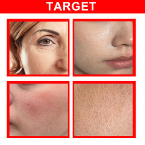 เซรั่ม<span class=keywords><strong>เลือด</strong></span><span class=keywords><strong>ม</strong></span>ังกร30<span class=keywords><strong>ม</strong></span>ล. ให้ควา<span class=keywords><strong>ม</strong></span>ชุ่มชื่นในเลือดทำให้รูขุ<span class=keywords><strong>ม</strong></span>ขนกระชับลดริ้วรอย - Product Image 6