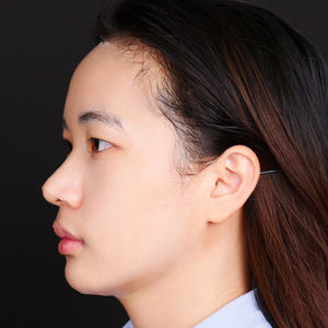 CMC <span class=keywords><strong>Hydrogel</strong></span> Regenerierte Zellulosefaser Gesichtsmaske mit Hyaluronsäure ODM Anpassbar Hautfreundlich Transparent Anti-Aging - Product Image 3