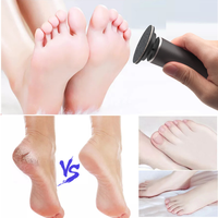 Appareil de soin des pieds anti-callosités, livraison directe, logo personnalisé, faible MOQ, livraison rapide, vente en gros, OEM, ODM, usine et fournisseur mondial