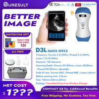 Sistema de ultrasonido de matriz en fase inalámbrico Suresult para uso médico de múltiples manijas Doppler de color