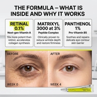 Crème pour les yeux en gel bio OEM/ODM, atténue les cernes, crème pour les yeux instantanée au rétinol pour tous types de peaux, crème anti-rides pour les yeux