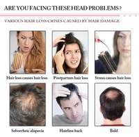 Appareil de croissance capillaire 650 nm pour usage en clinique de trichologie non médicale et en salon de coiffure, pour le traitement de la perte de cheveux