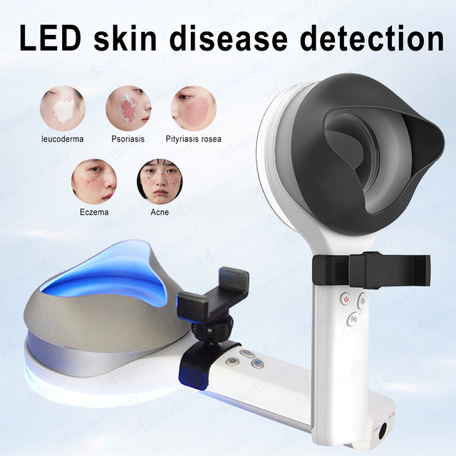 CE Certification Dermatology Woods Lamp Skin Analyzer Handheld Vitiligo Psoriasis Face Scanner Device for Human and Animals