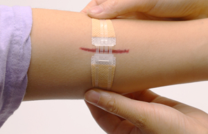 Closure Device Is Easy to Operate Just Align the Wound and Zip up Saving Emergency Treatment Time Custom - Product Image 4