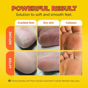 Masque de peau de <span class=keywords><strong>pied</strong></span> de citron de marque privée absorbant rapidement naturel élimine les odeurs masque de pieds doux exfoliant de bébé pour la peau sèche rugueuse - Product Image 5