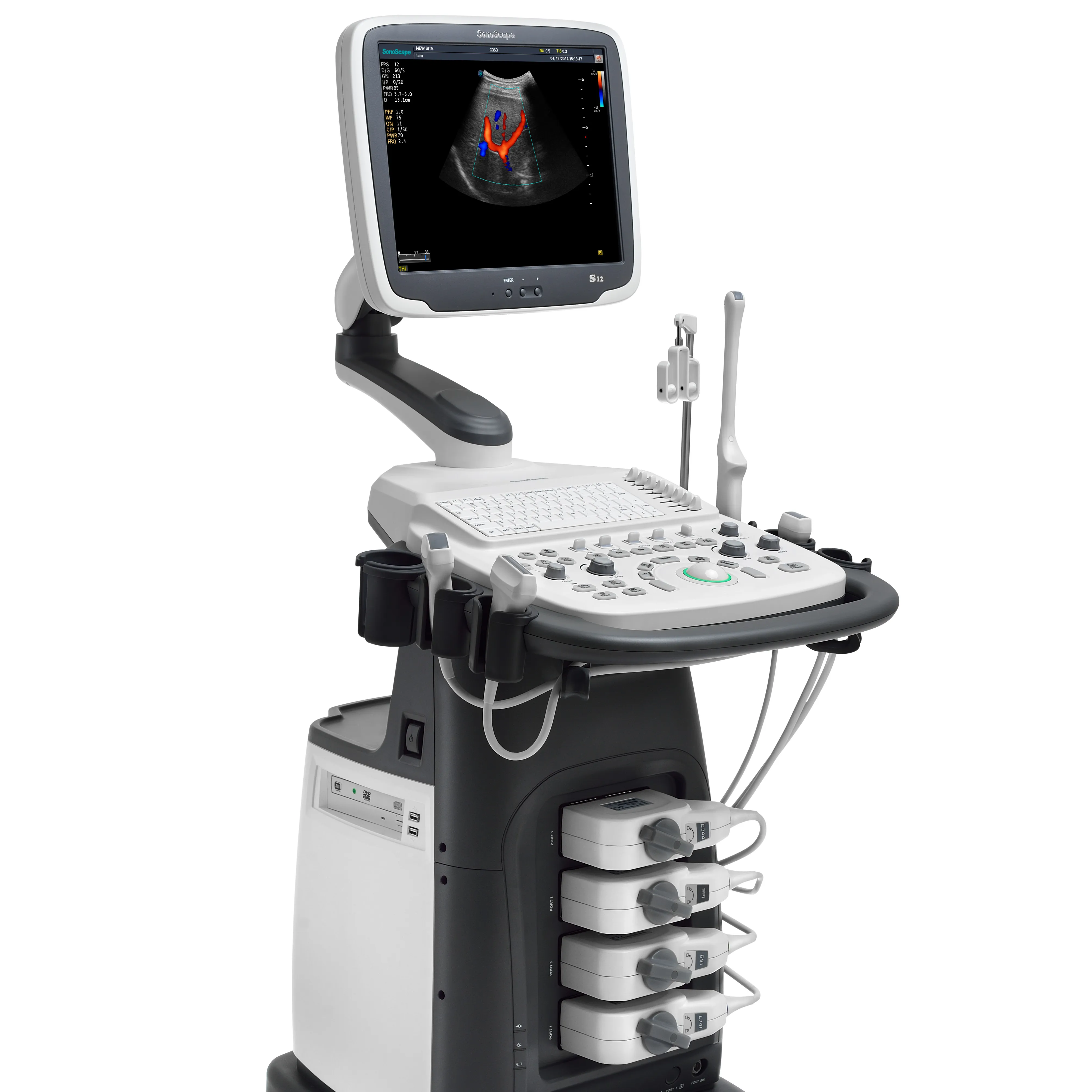 S12 Sonoscape ultrasonido रंग डॉपलर अल्ट्रासाउंड स्कैन मशीन बिक्री के लिए चिकित्सा उपकरण ट्रांसड्यूसर कीमत