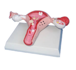 Geavanceerde pvc Vrouwelijke Interne Genitale orgel anatomisch Model - Product Image 5