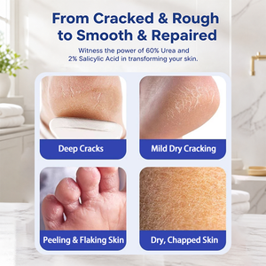 Crème pour les pieds à l'urée et à l'acide salicylique, marque privée, hydratante, exfoliante, réparatrice des peaux mortes, pour talons fendillés - Product Image 5