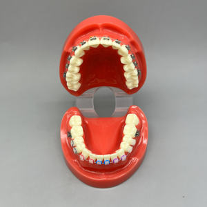 แบบจำลองการแสดงผลอุปกรณ์จัดฟันอุปกรณ์จัดฟันเครื่องช่วยสอนเปรียบเทียบโลหะ/เซรามิกสำหรับการสื่อสารระหว่างแพทย์คลินิกโรงพยาบาลผู้ป่วย - Product Image 4