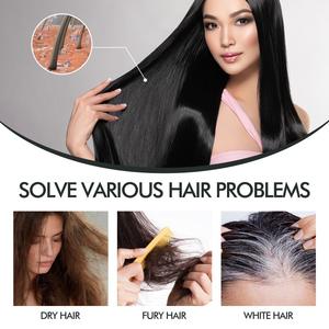 Vente en gros de <span class=keywords><strong>spray</strong></span> pour <span class=keywords><strong>cheveux</strong></span> <span class=keywords><strong>spray</strong></span> nourrissant pour le cuir chevelu favorisant la croissance couvrant les <span class=keywords><strong>cheveux</strong></span> <span class=keywords><strong>blancs</strong></span> <span class=keywords><strong>spray</strong></span> assombrissant pour <span class=keywords><strong>cheveux</strong></span> noirs naturels - Product Image 4