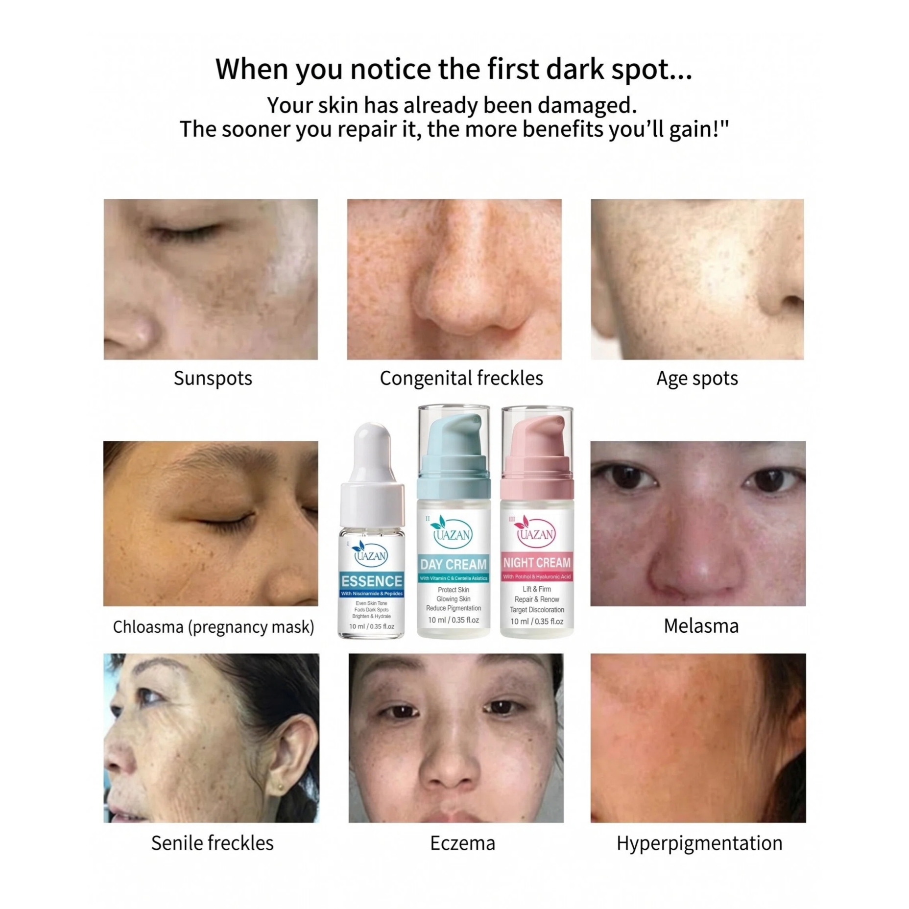 Wholesale Face Dark Spot Remover Kit Serum Cream For Women Hyaluronic Acid Smooth Brighten Protect Repair Skin Care Products