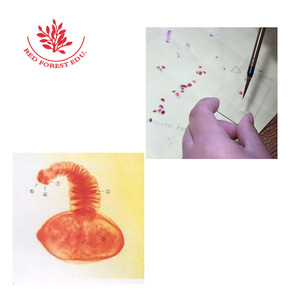Lames microscopiques du scolex de la larve de ver de la porcine, clairement structurées et fortement colorées, une lame microscopique d'une cysticérrose - Product Image 4