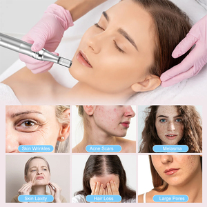 PAKISS - Pluma de Microagujas Inalámbrica de Venta Caliente de Fábrica, 0-2.5mm, Dispositivo de Belleza Antiarrugas, Derma Pen para Uso en Salón y en Casa - Product Image 2