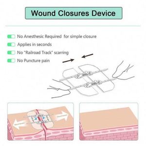 Best Quality China Manufacturer Assorted Different Sizes Disinfectable <b>Athletic</b> <b>Tape</b> - Product Image 3