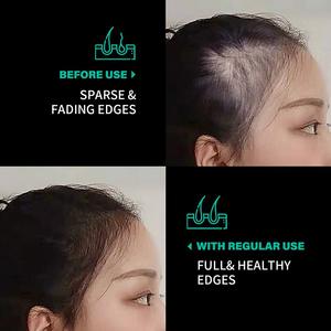 नए आगमन बैटाना तेल हेयर रेगेरोथ के लिए हेयर रेगेरोथ - Product Image 3