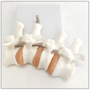 Modelo de lesión de osteoporosis de 4 vértebras médicas, modelo de esqueleto humano, anatomía, articulación, vértebras lumbares, modelo de esqueleto humano - Product Image 1