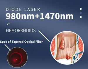 액세서리 인터페이스 SMA905 기계 부품 980nm 1470nm 파일 제거 600um 테이퍼 광섬유 - Product Image 2
