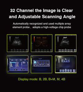 Mesin pemindai <span class=keywords><strong>Ultrasound</strong></span> Keyboard penuh, peningkatan baru diagnostik gema Notebook Digital B - Product Image 5