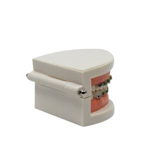 Modèle dentaire orthodontique pour exposition, alimentation électrique, matériau en résine avec comparaison métal-céramique, brackets et archwires - Product Image 5