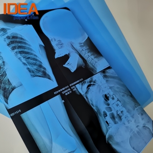 アイデアインクジェットデジタルX線ブルー医療用フィルムPET軟水溶性射出成形A3 A4 8x10 10x12 11x14 CT <span class=keywords><strong>DR</strong></span> MR用 - Product Image 2